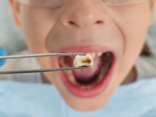 Best Emergency Gum Treatment in Genesee, ID