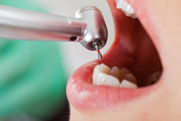 Best Cosmetic Emergency Dentistry in Genesee, ID